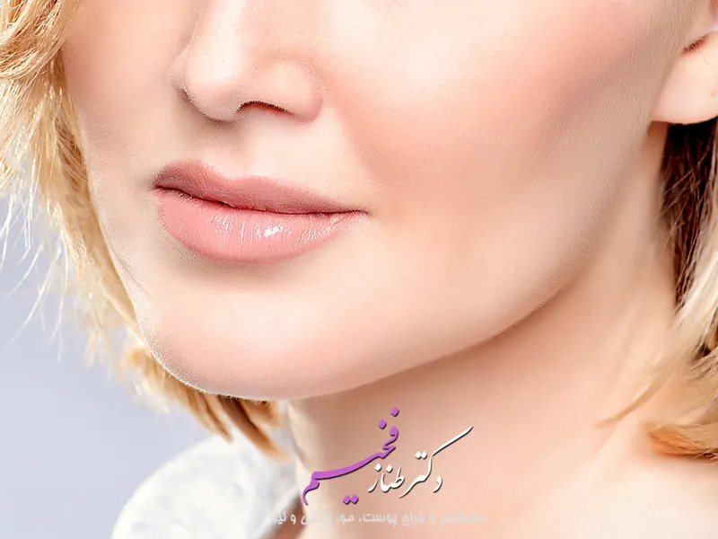 مادلینگ چهره