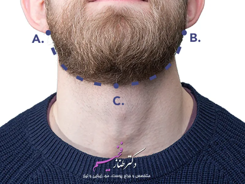 زاویه سازی صورت مردانه