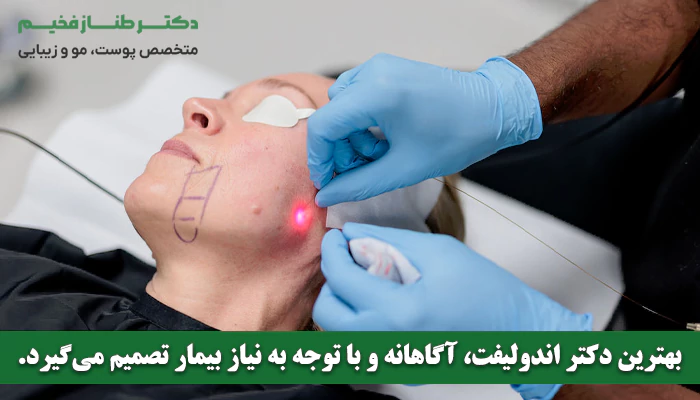 خصوصیات و ویژگی های بهترین دکتر اندولیفت در تهران چیست؟