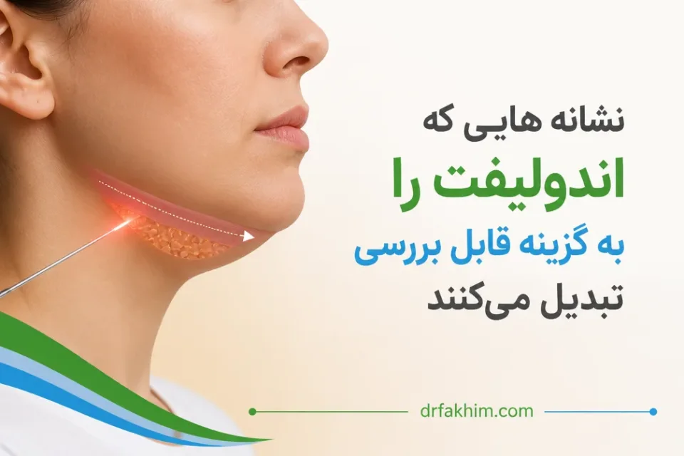 نمای توضیحی درباره نشانههایی که اندولیفت را به گزینه قابل بررسی تبدیل میکنند